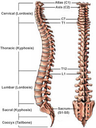 Scoliosis